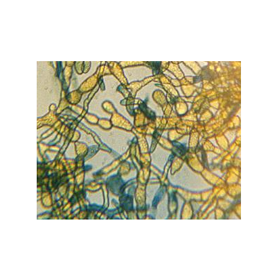 병원균(담자기 및 담자포자)