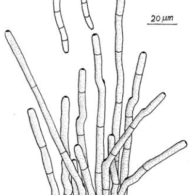 병원균(분생자경 및 분생포자)