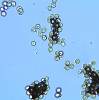 병원균(후막포자)