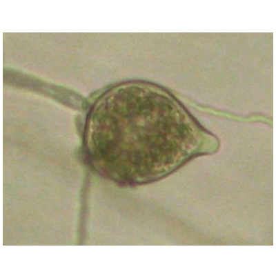 병원균(유주자낭)