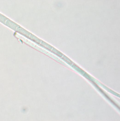 병원균(분생포자)