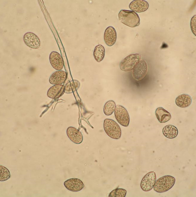 병원균(포자낭)