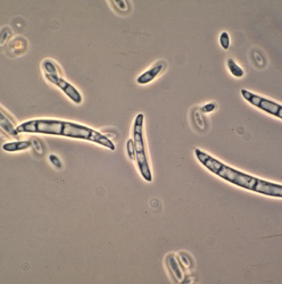 병원균(분생포자)