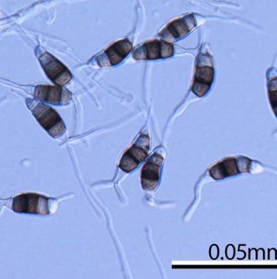 병원균(P. longiseta)