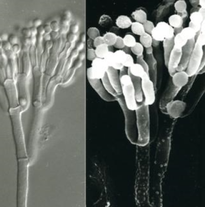 병원균(분생포자)