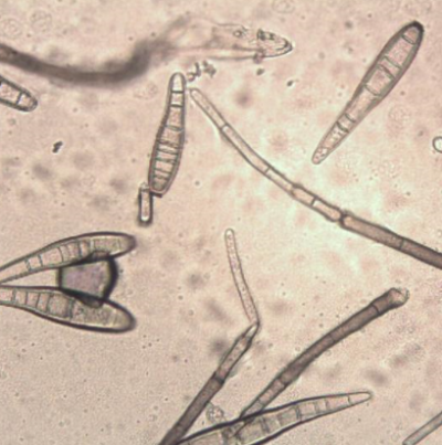 병원균(분생포자)