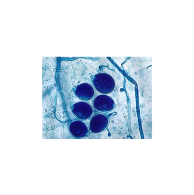 병원균(유주자낭) 