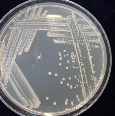 배지(TSA)에 형성된 병원균 Colony