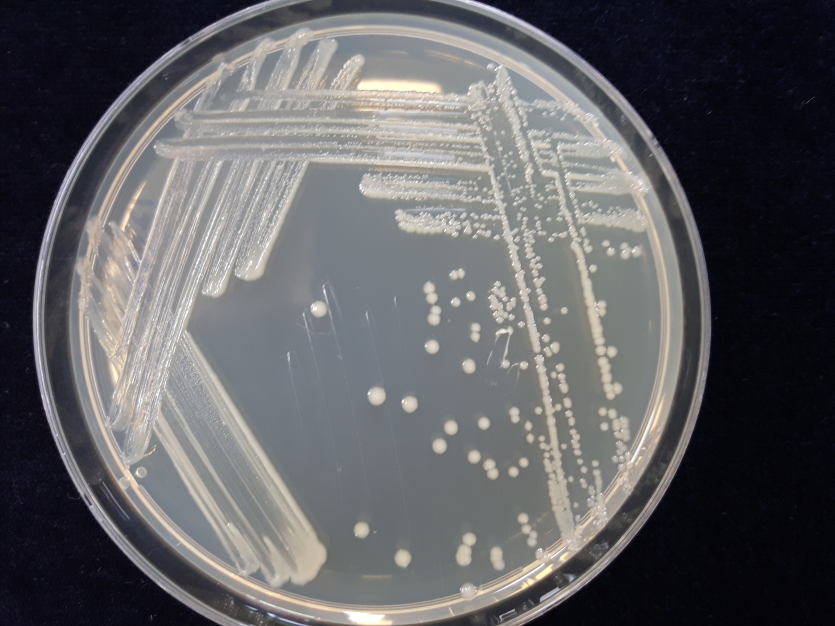 배지(TSA)에 형성된 병원균 Colony