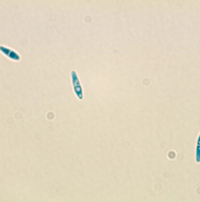병원균(자낭포자)