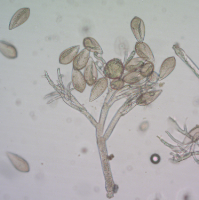 병원균(유주자낭)