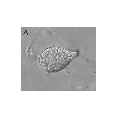 병원균(유주자낭)