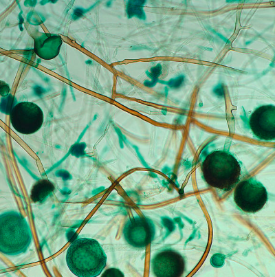 병원균(포자낭포자)