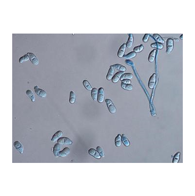 병원균(분생포자)