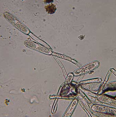 병원균(분생포자)