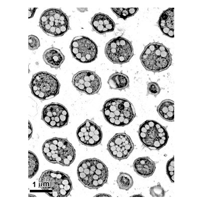 병원균(휴면포자)