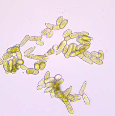병원균(분생포자)