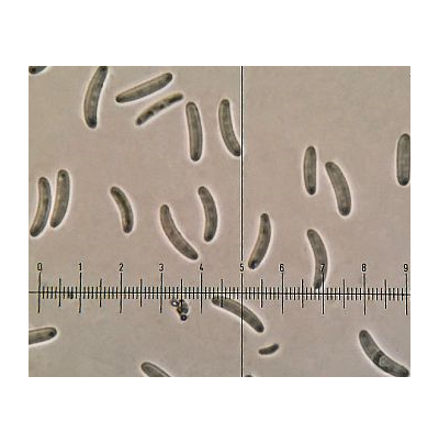 병원균 병포자(Leucostoma)