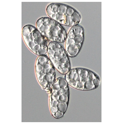 병원균(분생포자)