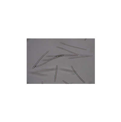 병원균(분생포자)