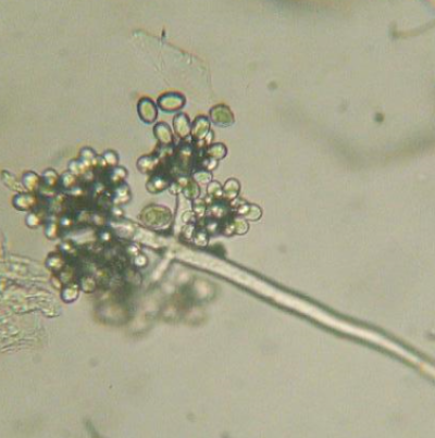 병원균(분생포자)  