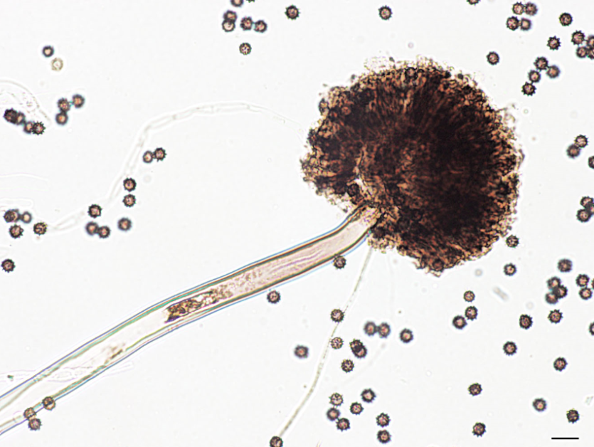 병원균(포자낭 및 포자)