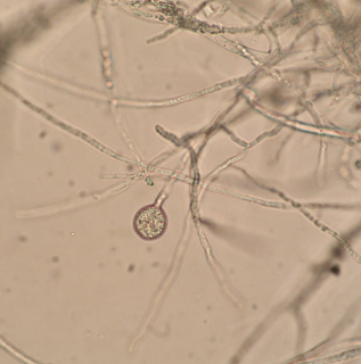 병원균(Pythium 난포자)