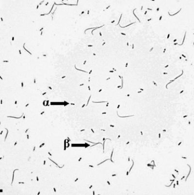 병원균(병포자)