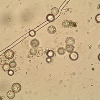 병원균(P. ultimum)