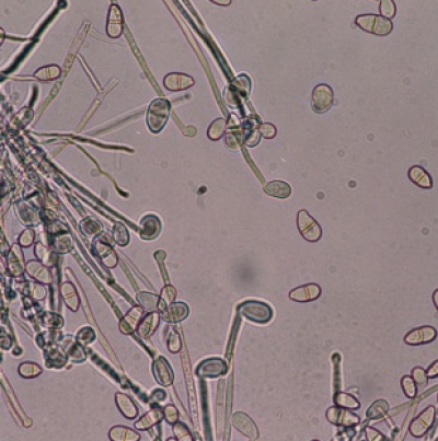 병원균(분생포자)