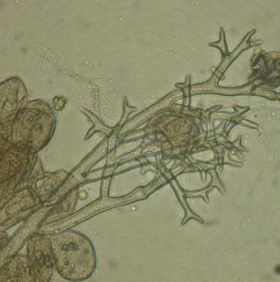 병원균(포자낭경 및 포자낭)
