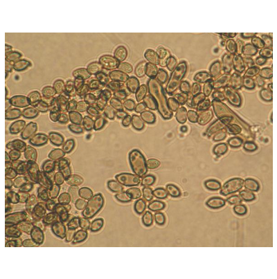 병원균 분생포자(C. cladosporioides)