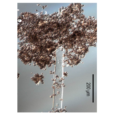 병원균(분생자경)