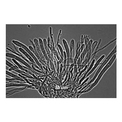 오디균핵병 병원균 자낭