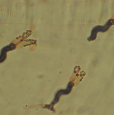 병원균(분생자경 및 분생포자)