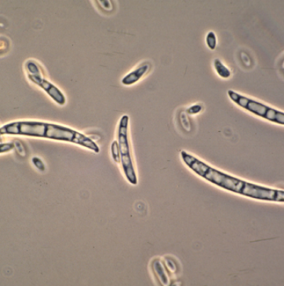 병원균(분생포자)