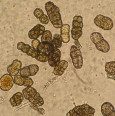 병원균(분생포자)
