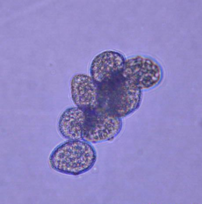 병원균(하포자)