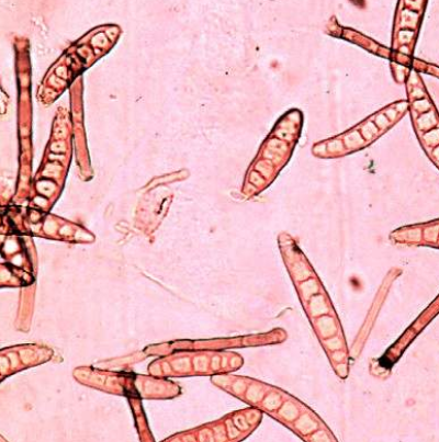 옥수수 깨시무늬병 병원균 분생포자