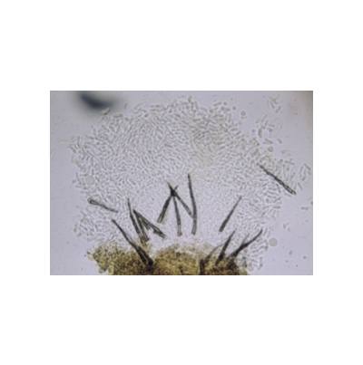 수수 탄저병 병원균 분생포자