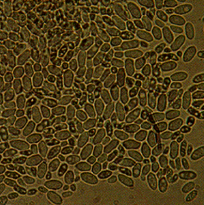 보리 세팔로스포리움줄무늬병 병원균 분생포자