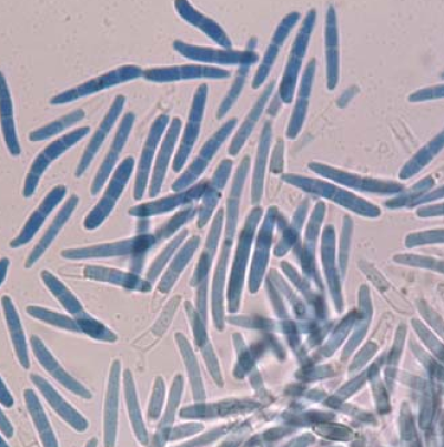보리 이삭마름병 병원균 분생포자