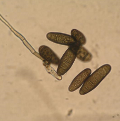 보리 점무늬병 병원균 분생포자