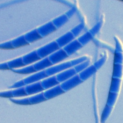 이삭곰팡이병 병원균 F. moniliforme 분생포자