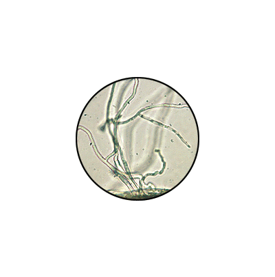 보리 잎집눈무늬병 병원균 균사