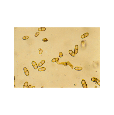 보리 그을음병 병원균(C. herbarum)