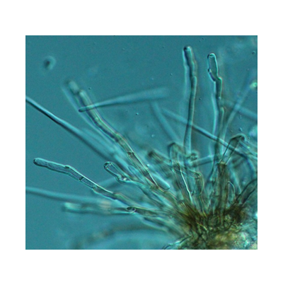 점무늬병 병원균 포자낭병