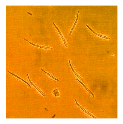 보리 눈무늬병 병원균 분생포자