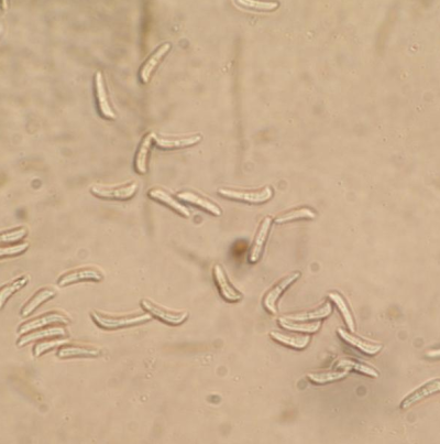 보리 구름무늬병 병원균 분생포자